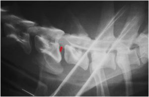 מיאלוגרפיה של כלב הסובל מפריצת דיסק צווארית