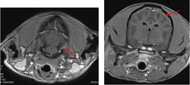  transverse T1 post contras של בדיקת ה MRI בחלקים שונים של המוח